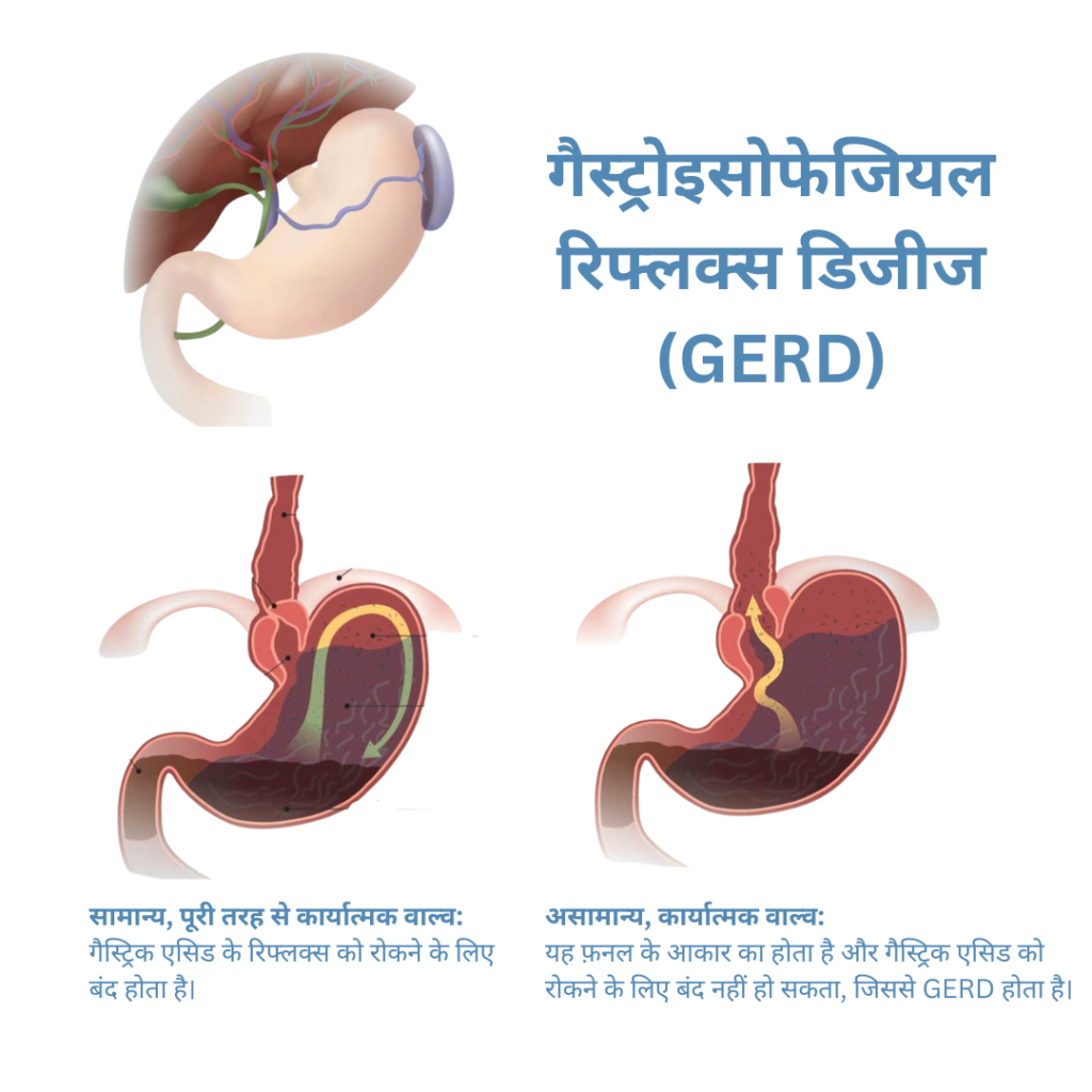 2 1 - Laparoscopic Surgeon Dr. Digant Pathak