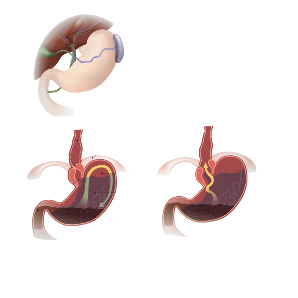 4 2 - Laparoscopic Surgeon Dr. Digant Pathak