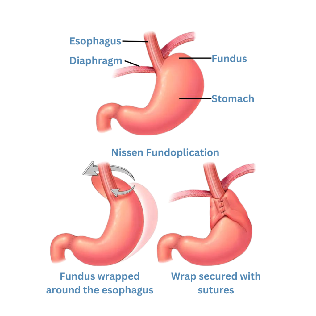 5 1 - Laparoscopic Surgeon Dr. Digant Pathak