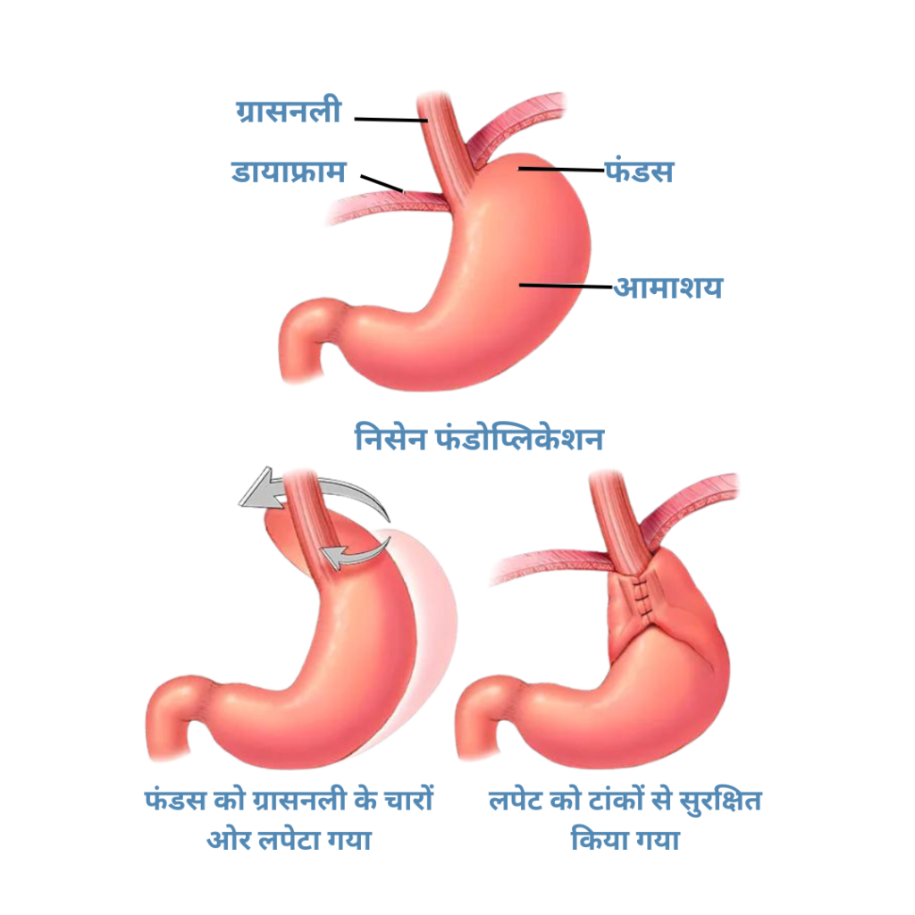 6 1 - Laparoscopic Surgeon Dr. Digant Pathak