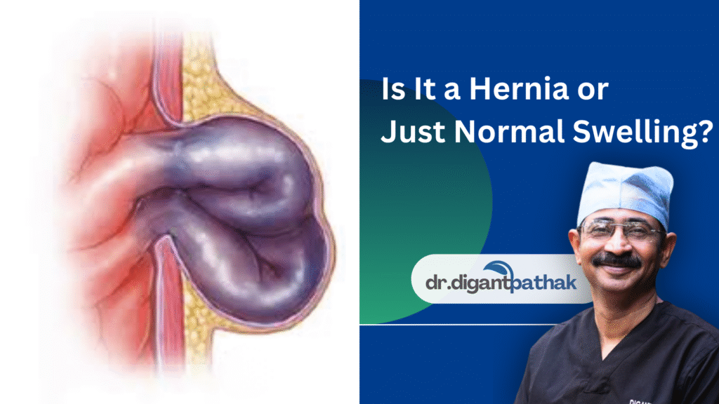 1 - Laparoscopic Surgeon Dr. Digant Pathak