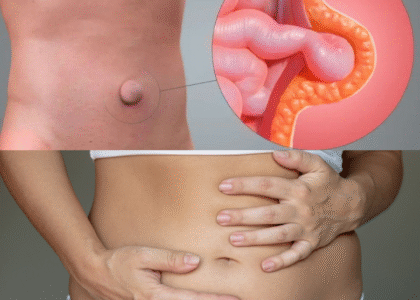 432 - Laparoscopic Surgeon Dr. Digant Pathak