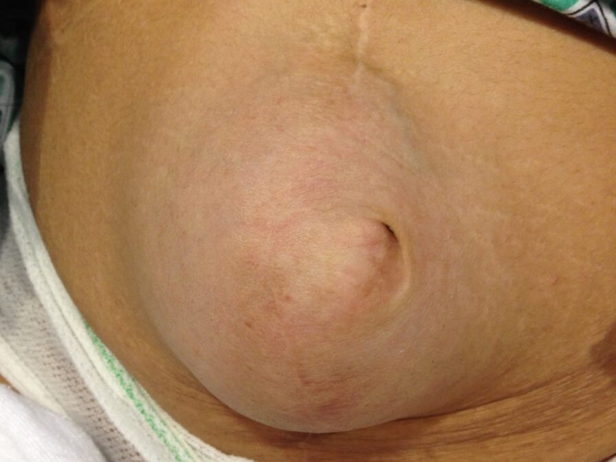 IMG 0087 896x1024 1 edited - Laparoscopic Surgeon Dr. Digant Pathak