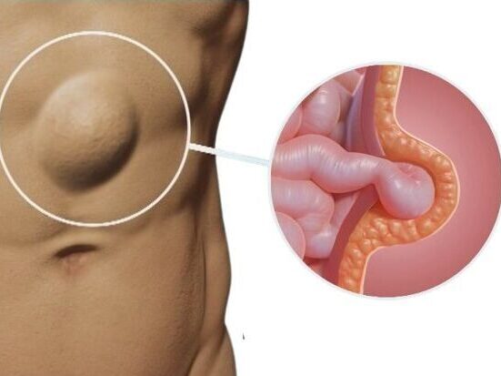 img edited 1 - Laparoscopic Surgeon Dr. Digant Pathak