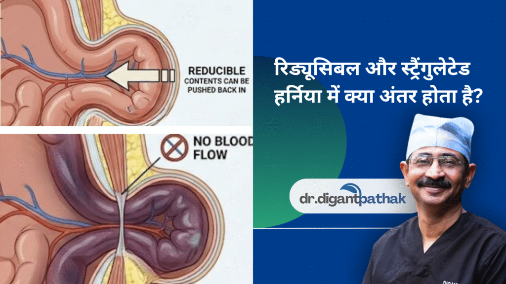18 - Laparoscopic Surgeon Dr. Digant Pathak