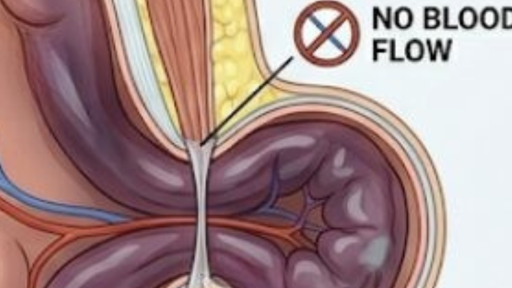 19 edited 1 - Laparoscopic Surgeon Dr. Digant Pathak