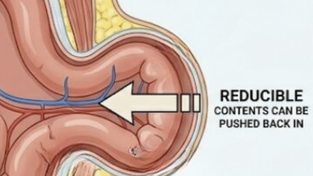 19 edited - Laparoscopic Surgeon Dr. Digant Pathak