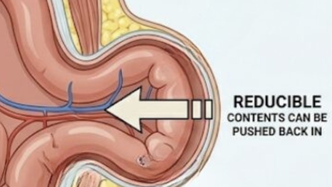 19 edited - Laparoscopic Surgeon Dr. Digant Pathak