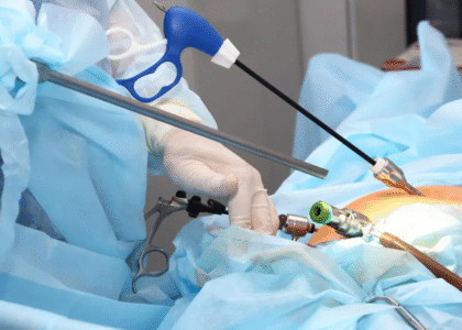 19830 - Laparoscopic Surgeon Dr. Digant Pathak