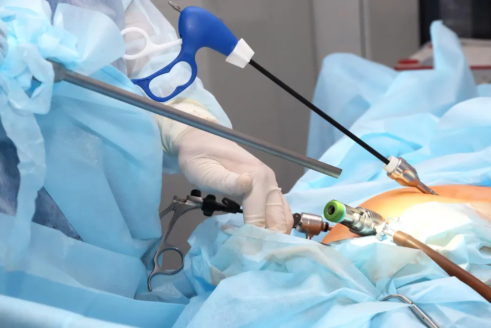19830 - Laparoscopic Surgeon Dr. Digant Pathak