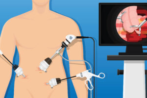 3 - Laparoscopic Surgeon Dr. Digant Pathak