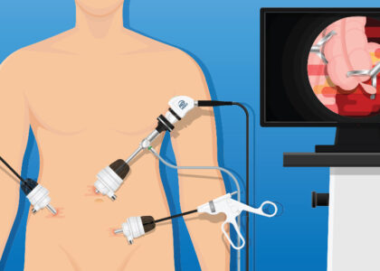 3 - Laparoscopic Surgeon Dr. Digant Pathak