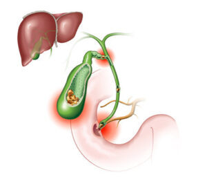 360 F 491890332 oS269crFsCNB42BD5OOSDrKWOMSwfAU1 - Laparoscopic Surgeon Dr. Digant Pathak