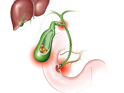 360 F 491890332 oS269crFsCNB42BD5OOSDrKWOMSwfAU1 - Laparoscopic Surgeon Dr. Digant Pathak
