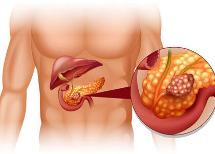 acute - Laparoscopic Surgeon Dr. Digant Pathak
