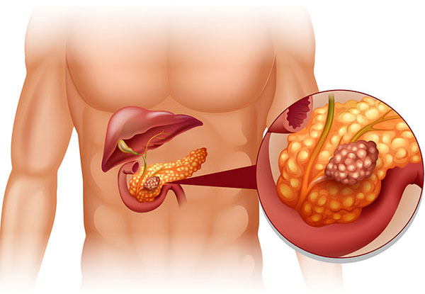 acute - Laparoscopic Surgeon Dr. Digant Pathak