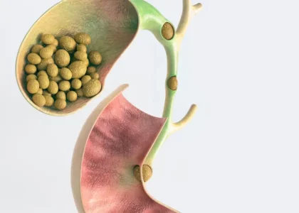 gallbladder disease gallstones - Laparoscopic Surgeon Dr. Digant Pathak