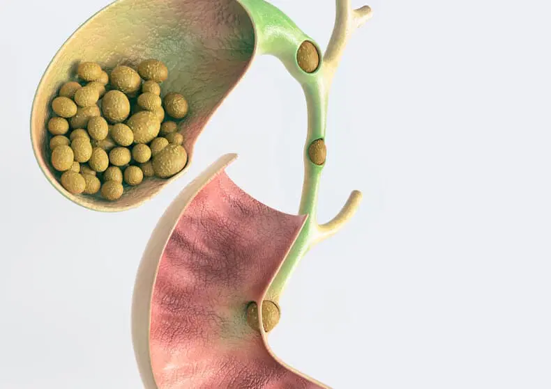 gallbladder disease gallstones - Laparoscopic Surgeon Dr. Digant Pathak