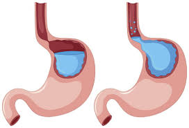 images - Laparoscopic Surgeon Dr. Digant Pathak