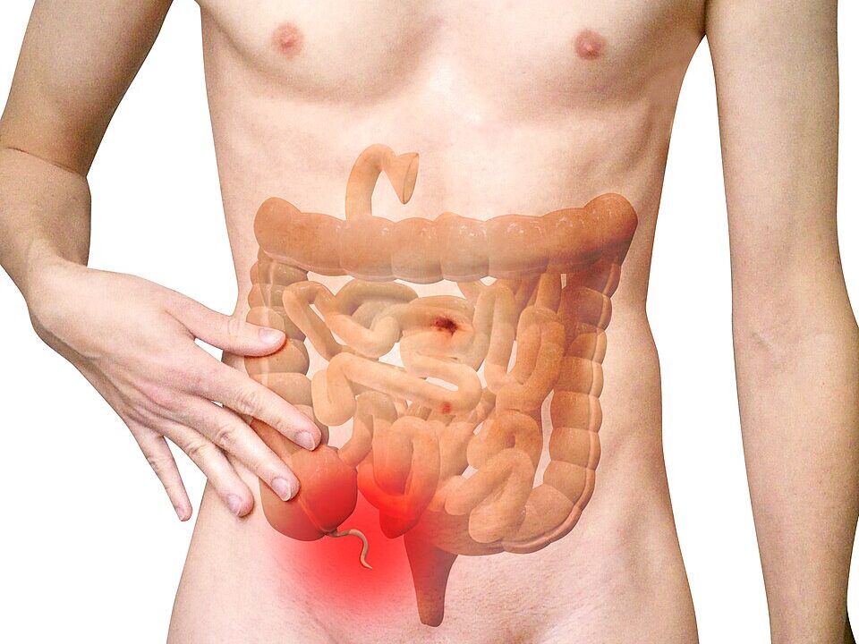 Appendix Surgery Understanding Appendicitis and Emergency Surgical Care edited - Laparoscopic Surgeon Dr. Digant Pathak