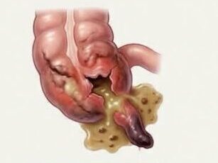 1779130981291 edited 5 - Laparoscopic Surgeon Dr. Digant Pathak