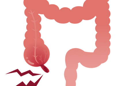 51 edited - Laparoscopic Surgeon Dr. Digant Pathak