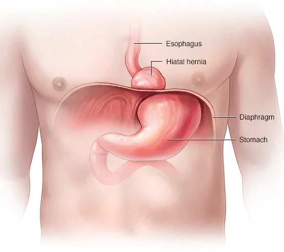 ds00099 im01191 ww5rl88thu jpg edited - Laparoscopic Surgeon Dr. Digant Pathak