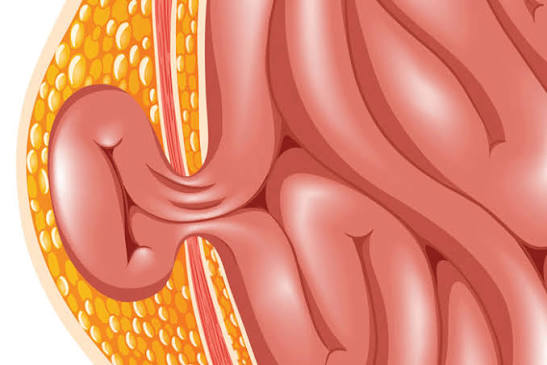 images 3 - Laparoscopic Surgeon Dr. Digant Pathak