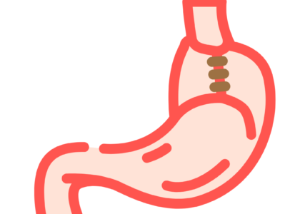 59 edited - Laparoscopic Surgeon Dr. Digant Pathak