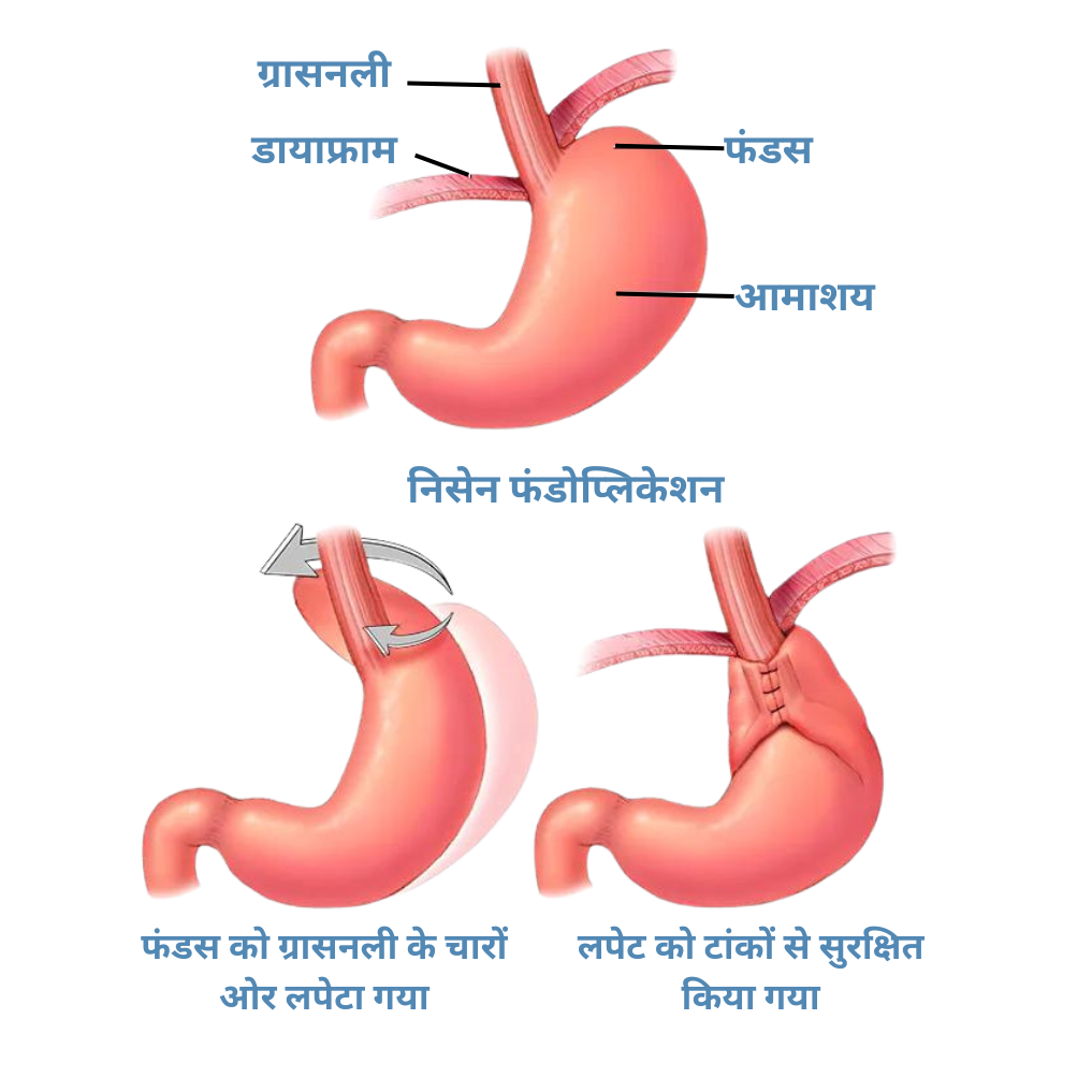 6 1 edited - Laparoscopic Surgeon Dr. Digant Pathak